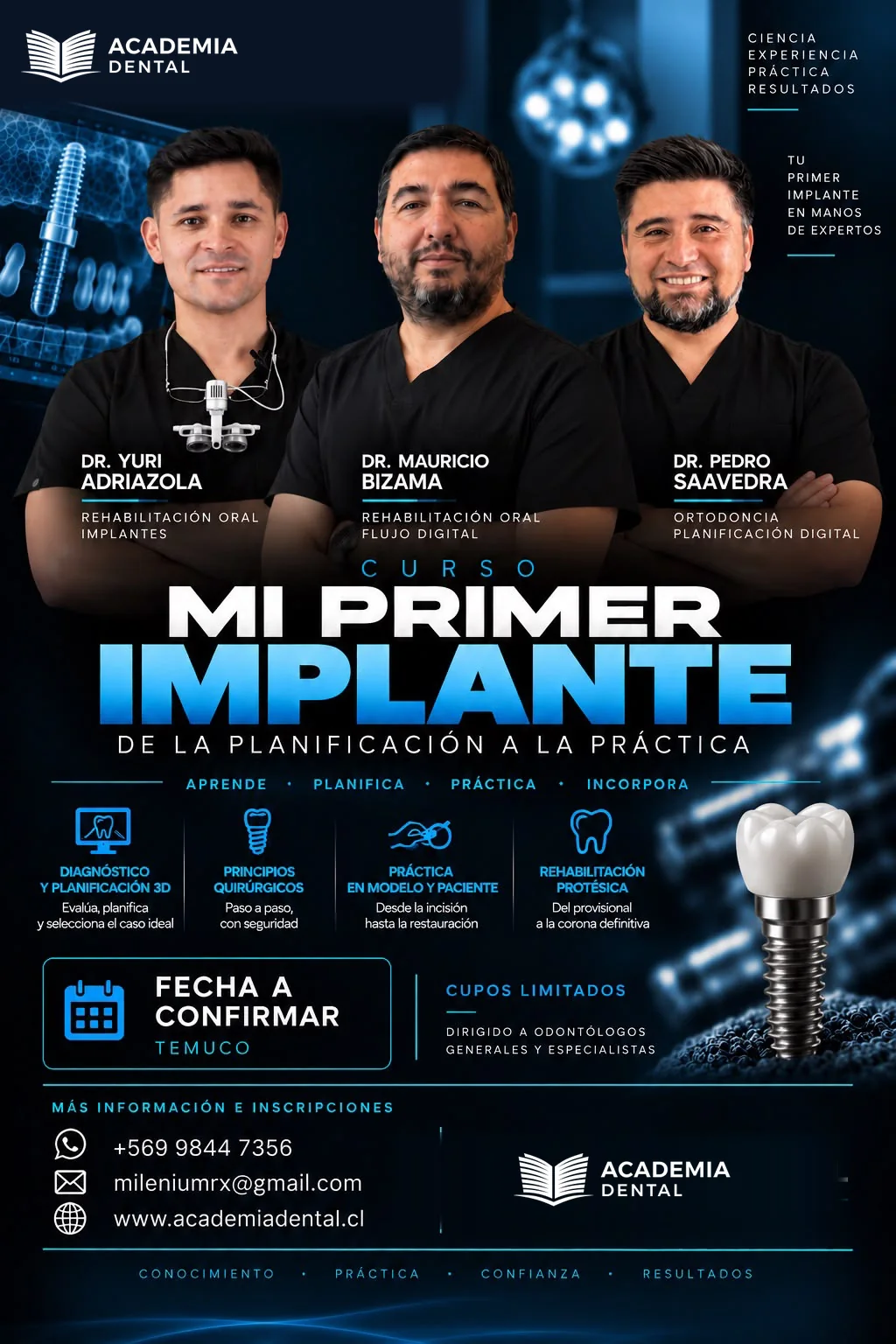 Mi Primer Implante Unitario