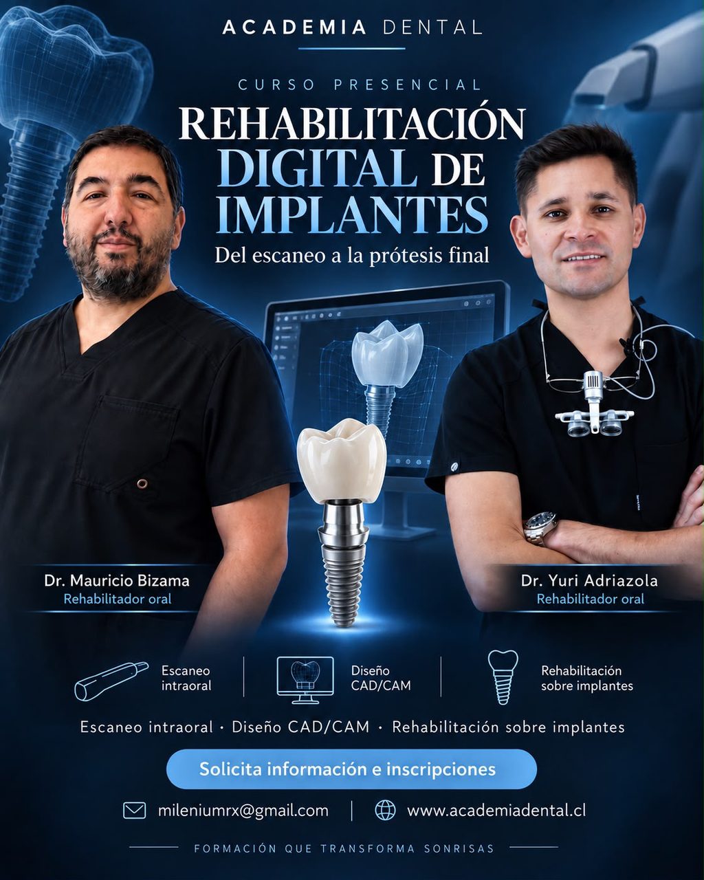 Rehabilitación Digital de Implantes